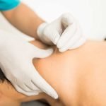 Dry Needling Physical Therapy